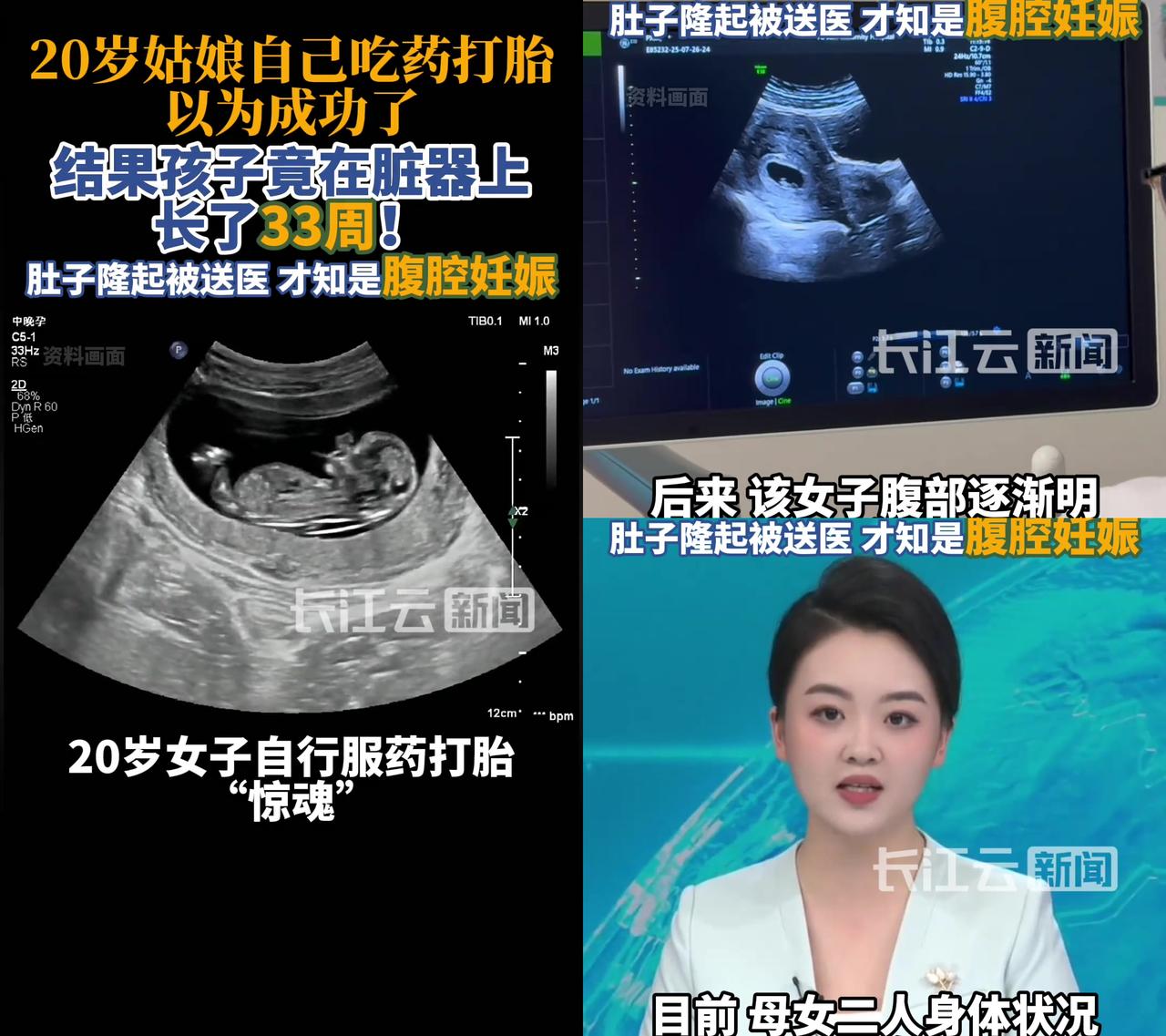 20岁姑娘药流没复查，差点把自己送进鬼门关哈尔滨这姑娘自己吃打胎药，以为