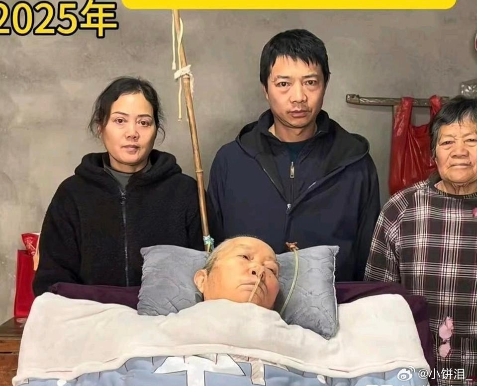 一个病人是如何拖垮一个家的…