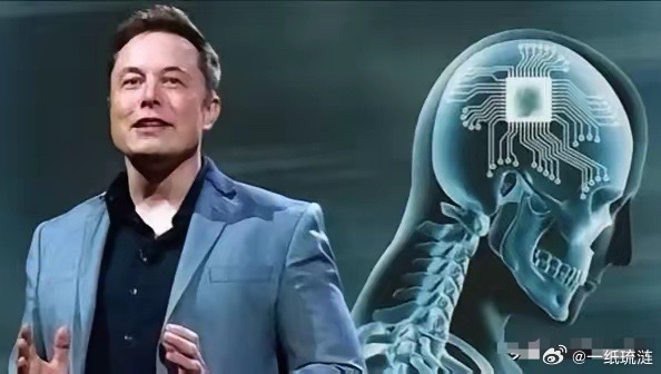 马斯克又一天才创举惊艳世界，脑机接口将终结肉身残缺！而且今年就要量产！什么概念？