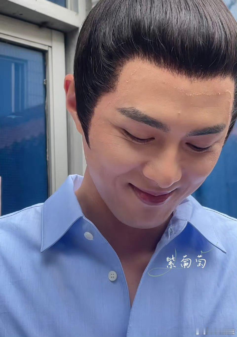 叶祖新的脸怎么了？是过敏了吗？还是头套胶水导致的？面部泛红肤色不均匀，看着较为严