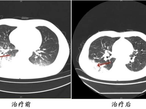 “悲剧还是发生了！”6月26日，湖北，一男子觉得热，把2年没洗的空调打开