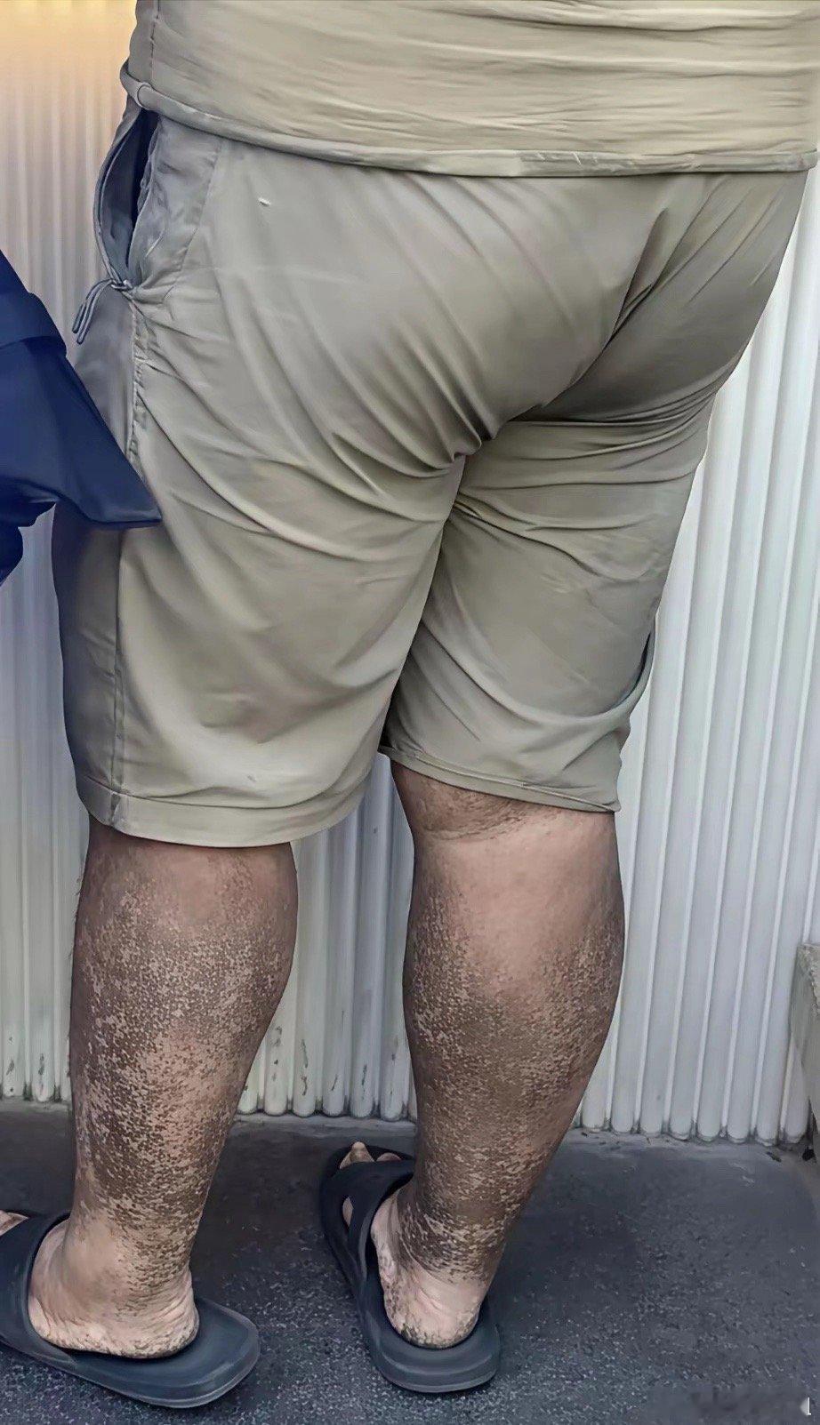 这种人送外卖，看到了你们吃得下吗