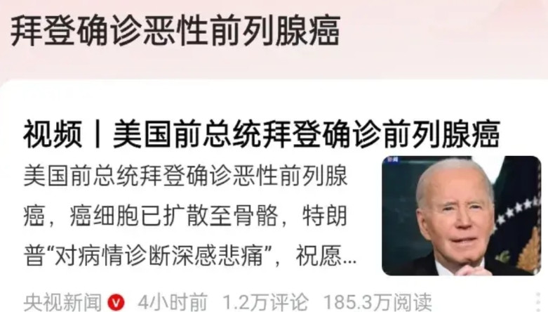 以前很多人吹，美国医疗技术世界领先。有很多网友不相信，现在证明它的机会来了！据