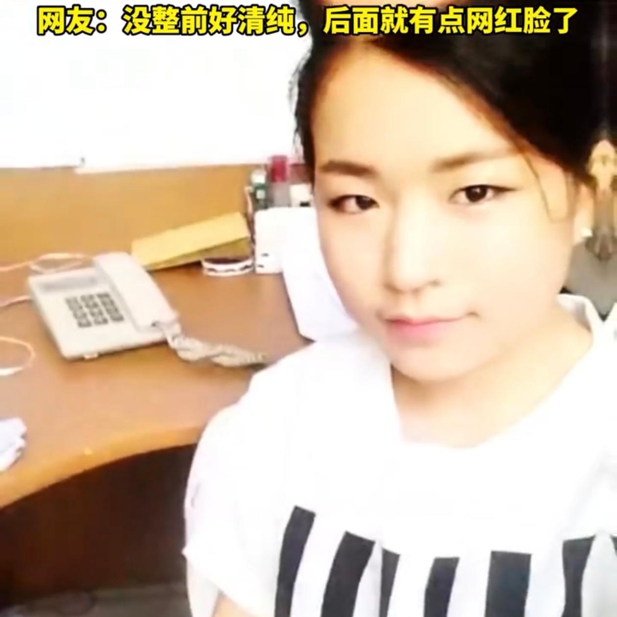 浙江一女子35岁，交了个00后男朋友，直接在网上把整容前后的照片摆出来了，脸变小