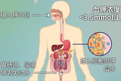 长期吃降压药的人，身体若有5个表现，或是“缺钾”了！注意补充在一个阳光和煦的