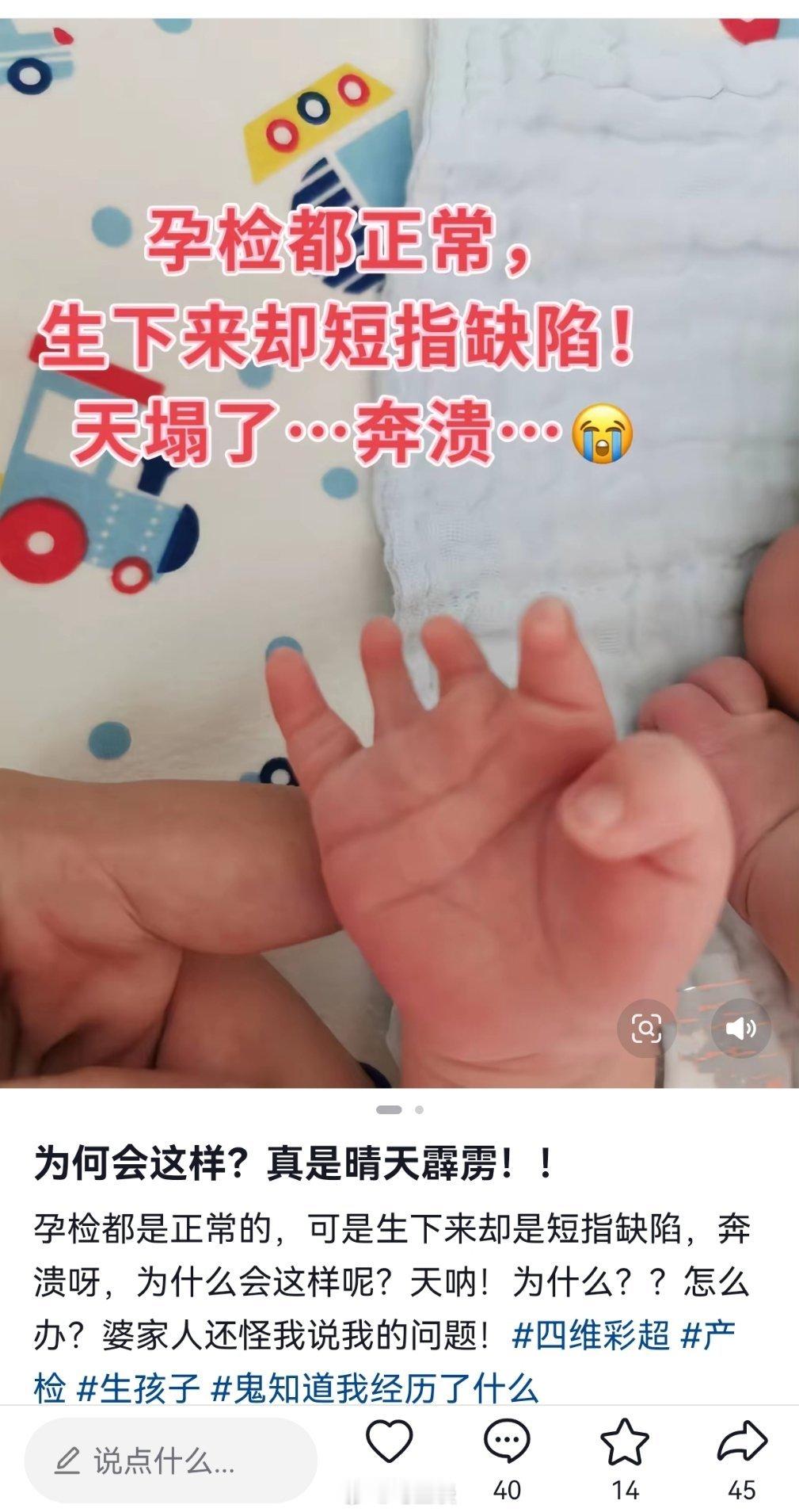 试管婴儿出生右脚缺4趾产检未发现产检没发现手指脚趾畸形缺失的案例很多，为什么？