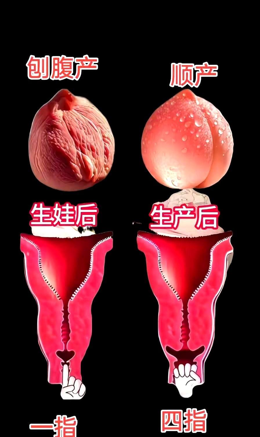 一个三胎宝妈经验告诉我，只有顺过的人才懂胯骨松垮垮的还漏，顺产的后遗症还真太多了