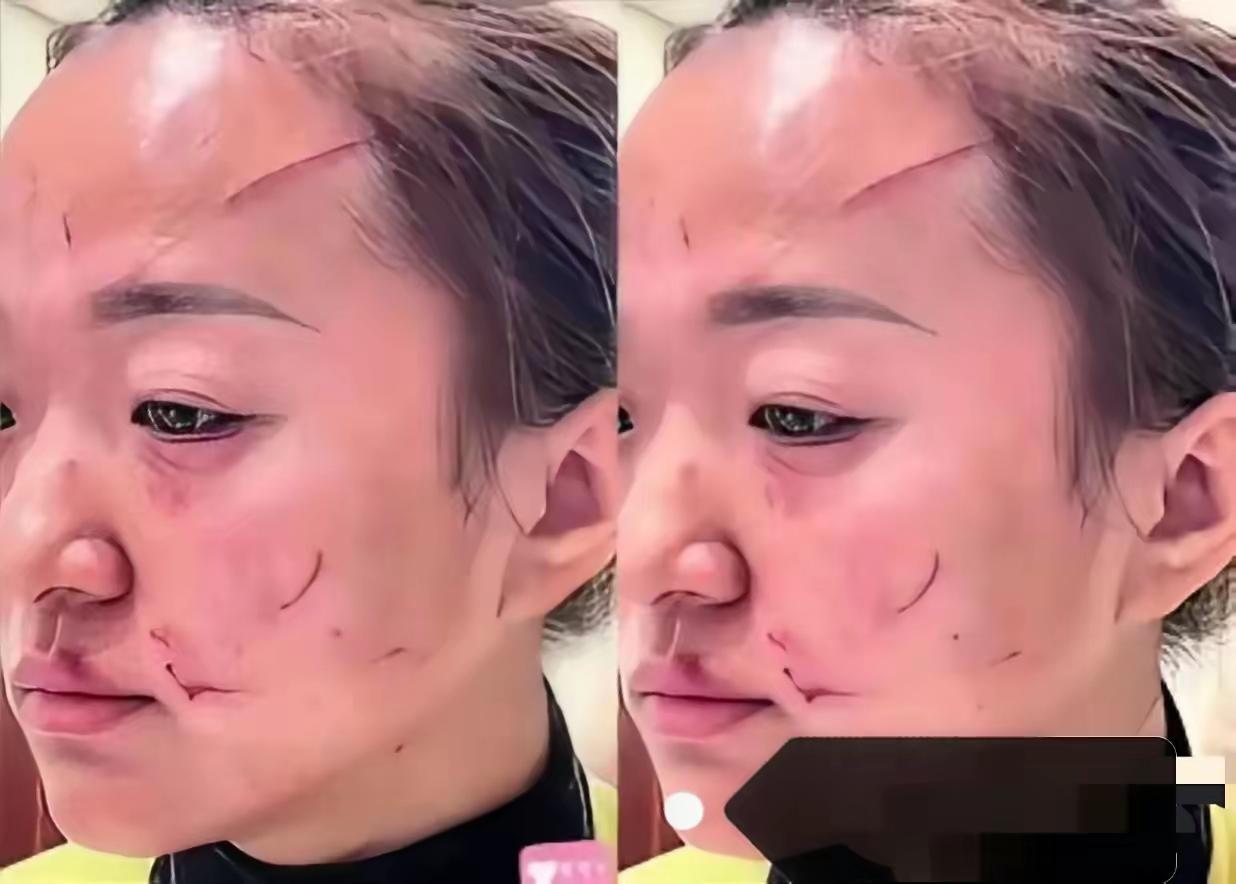 家家有本难念的经！婆媳打架后续来了。经警察调解，婆婆拿出5万给媳妇，从此各