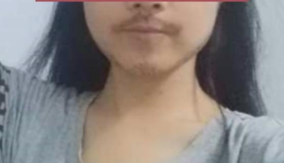 “愁坏了！”9月1日报道，浙江宁波，一16岁女孩上高中后，月经好几个月不来，脸上