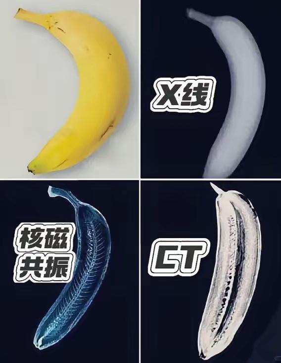 一张图教你看懂核CT、核磁共振、X光的区别！形象点说，同一根香蕉，X光只能查