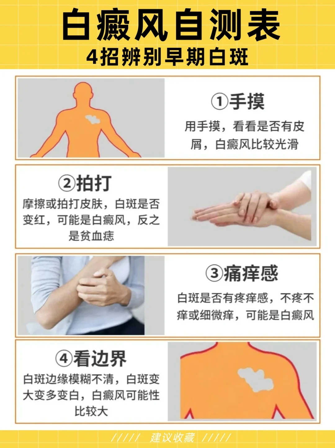 🔍一图看懂白斑，是不是早期白癜风！