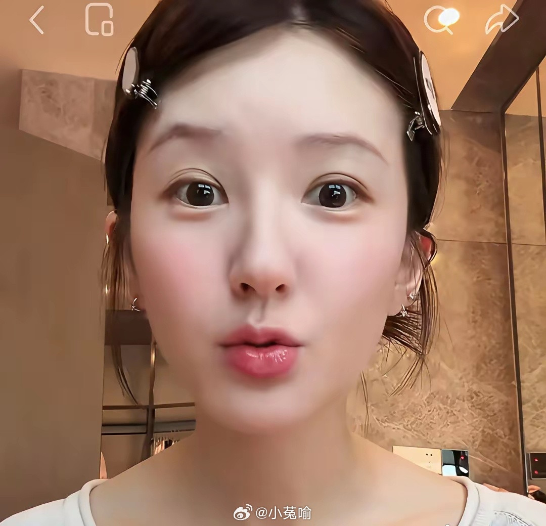 赵露思的唇从韩国回来更加丰满了