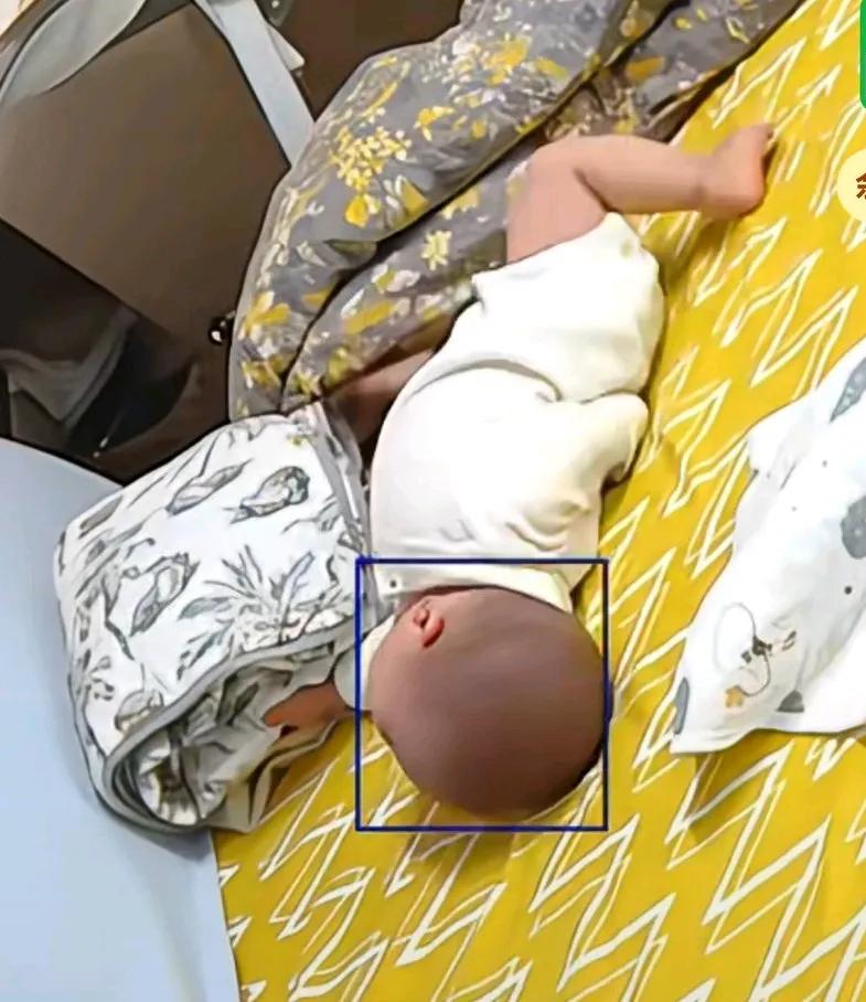 宝宝在床上翻身时，把胳膊压在身下，竟然脱臼了，没想到小宝宝自主翻身还可以吧，胳