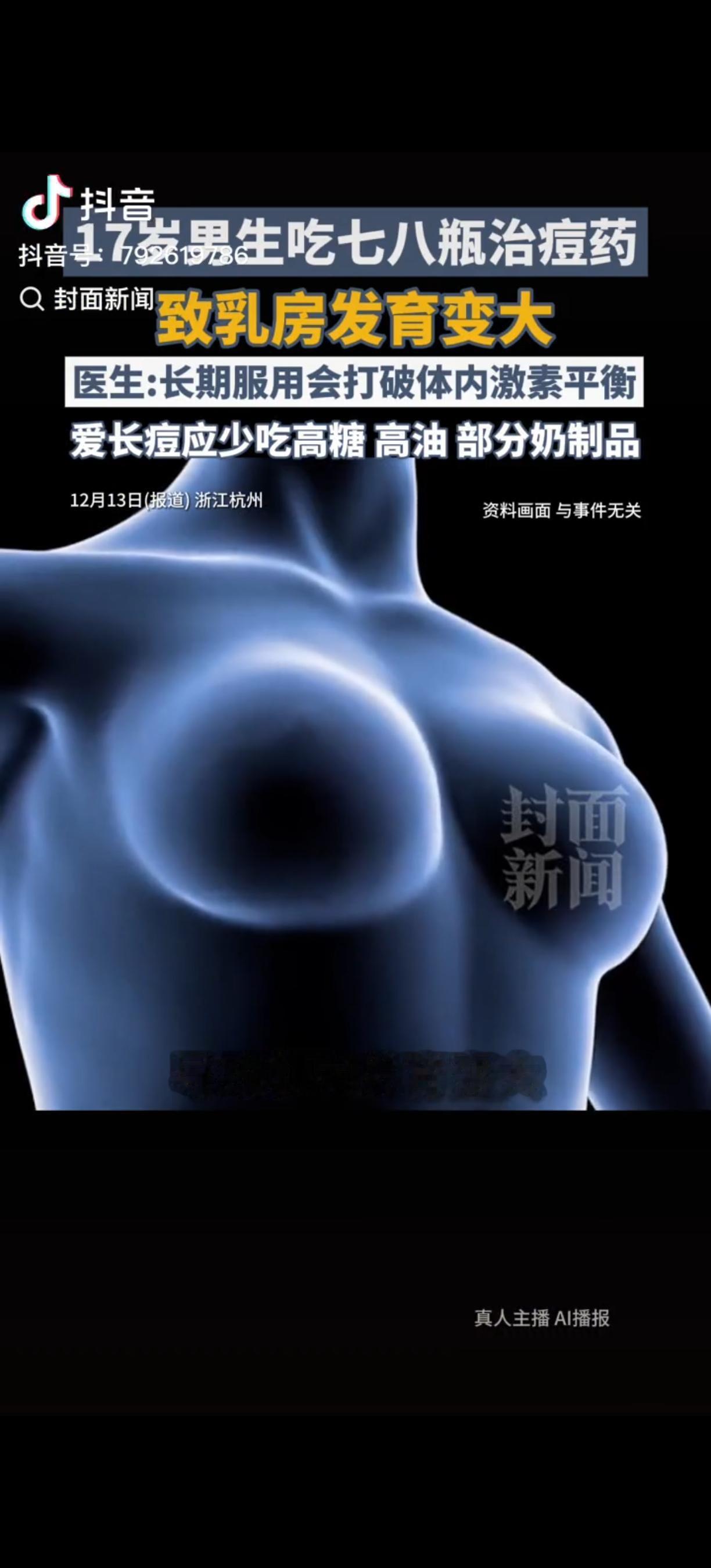 “离了个大谱。”浙江杭州，一男生青春期长痘，在医生的建议下服用药物，刚开始痘痘确