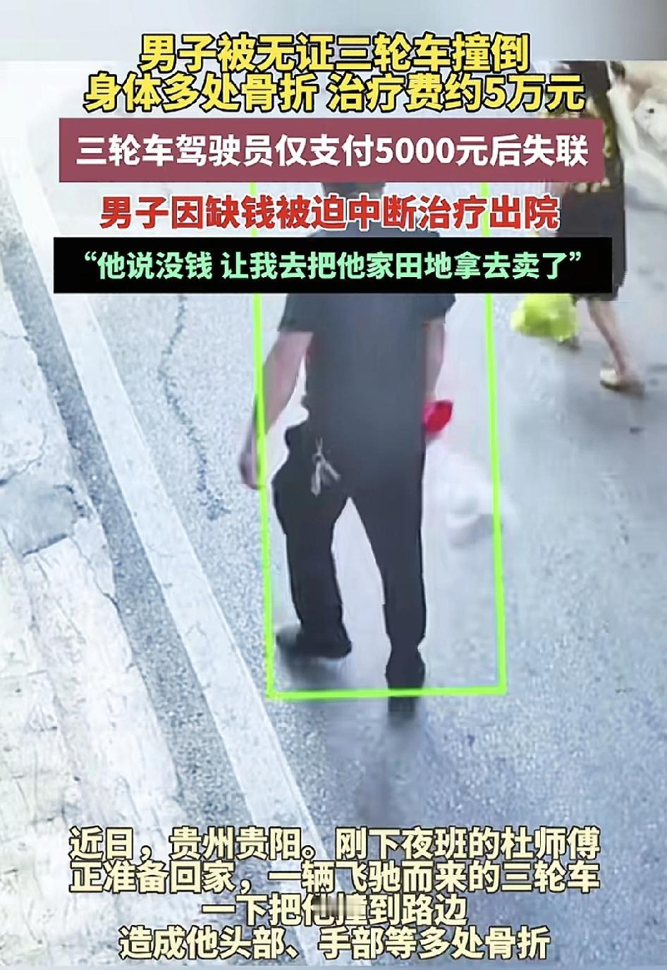 贵州贵阳一男子下夜班之后备一辆无证驾驶的三轮车组撞伤，男子身上多处骨折，医疗费用