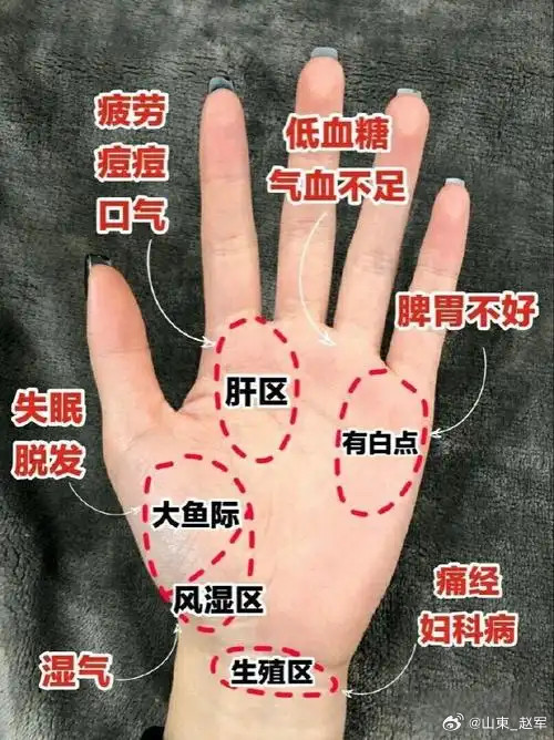 手诊歌诀一、流派总诀 晨霞手诊看纹形，十四主线八纹精。只观纹络不看色，实证万例