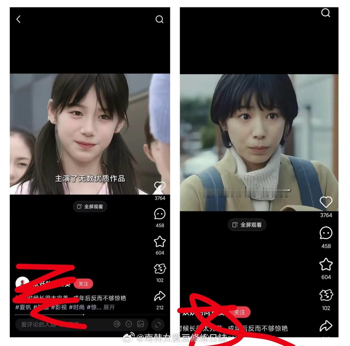 所以说整牙要趁早。年轻时候微凸老了只会越来越凸（口周肌肉紧张面部胶原蛋白流失