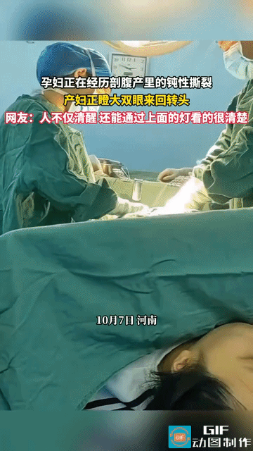 网友吓傻了:河南，一产妇躺在手术床上正在进行剖腹产，两个医生一人一边使劲拉扯产妇