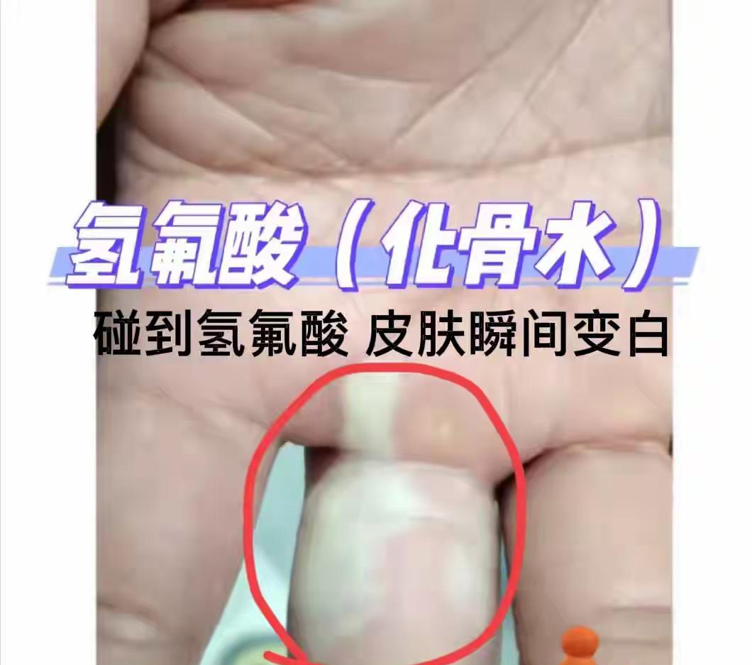 这是祸从天降女子散步踩氢氟酸（俗称化骨水）去世了9月9日杭州52岁的涂女士