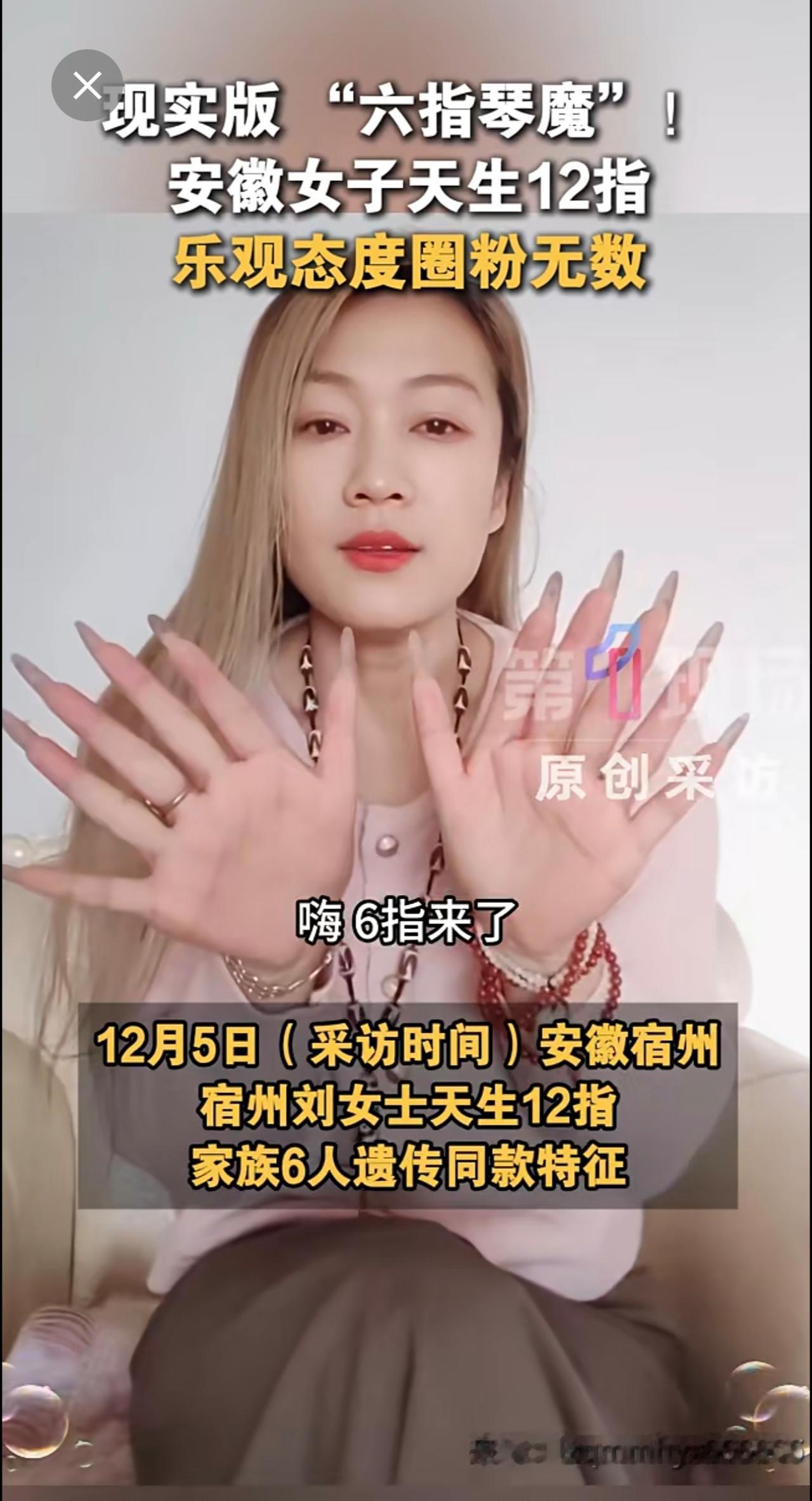 12月5日（采访时间），安徽宿州，刘女士天生12指，家族6人遗传同款特征。曾因手