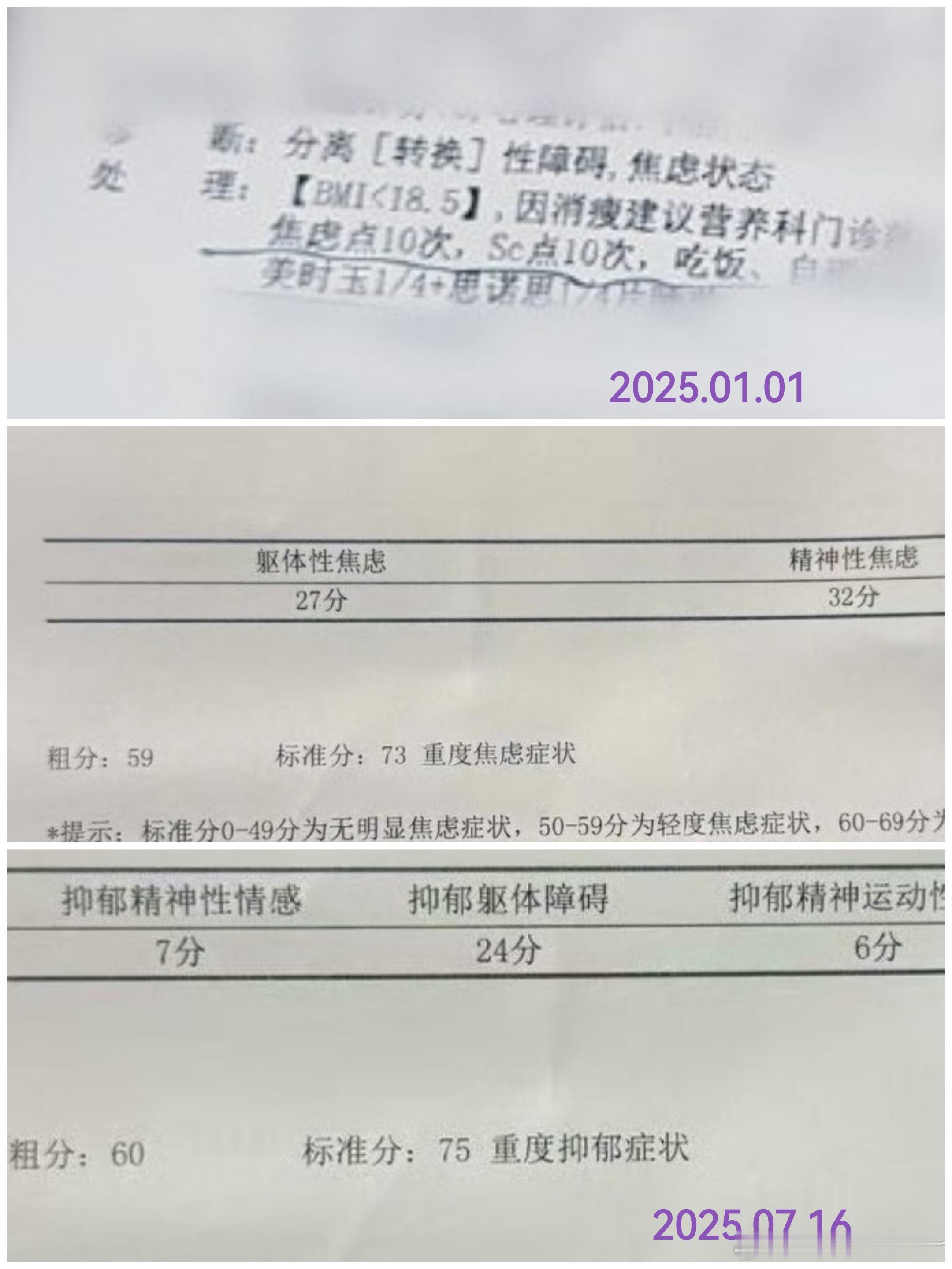 赵露思患重度抑郁和重度焦虑七个月重度抑郁和焦虑好好好七个月让露思越来越受伤露思，