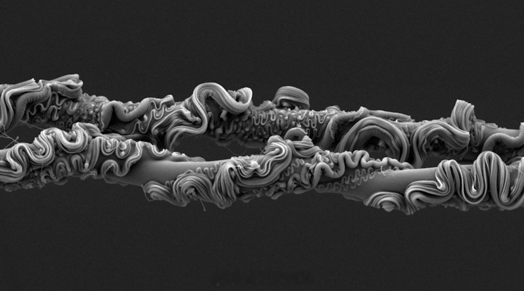 蜘蛛丝的电子显微镜摄像，byDrMartínRamírez。蜘蛛显微摄影