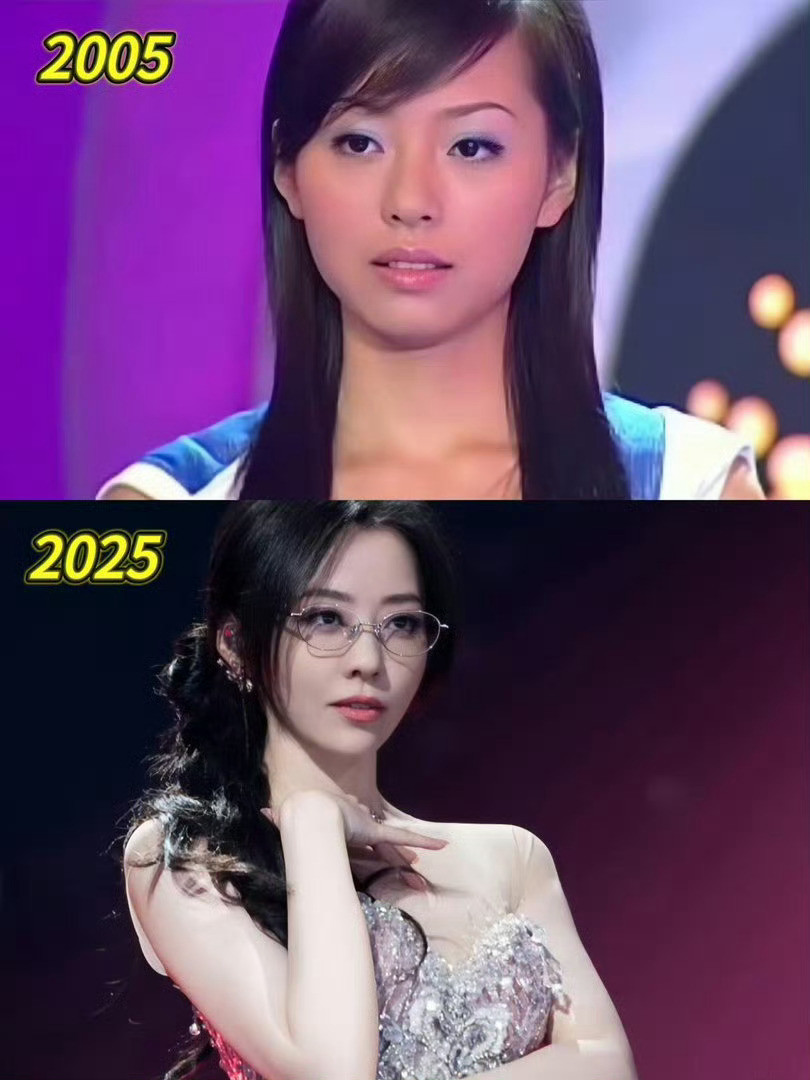 近日，42岁的张靓颖大方承认整容，放眼整个娱乐圈，没有哪个女明星不做医美的，甚至