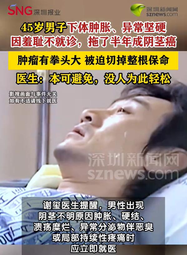 “悲剧还是发生了！”浙江杭州，45岁男子发现自己下体又肿又硬。但因为是私密部位，