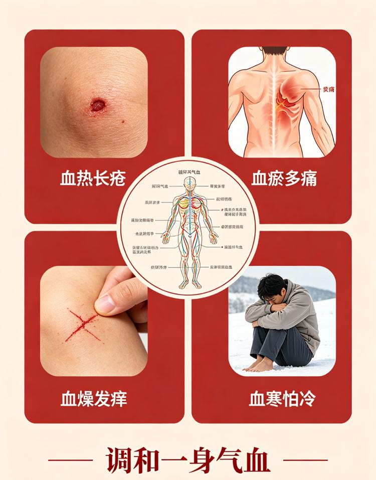 血热长疮，血瘀多痛，血燥发痒，血寒怕冷，4个中成药，调和一身气血一、血热长疮