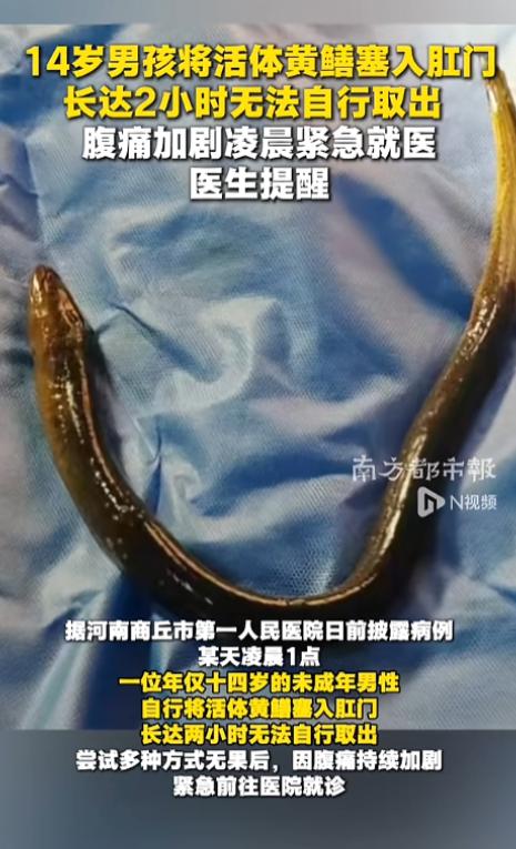 “怎么下的去手的呢！”5月25日报道，河南商丘14岁少年因将活黄鳝塞入肛门被紧急