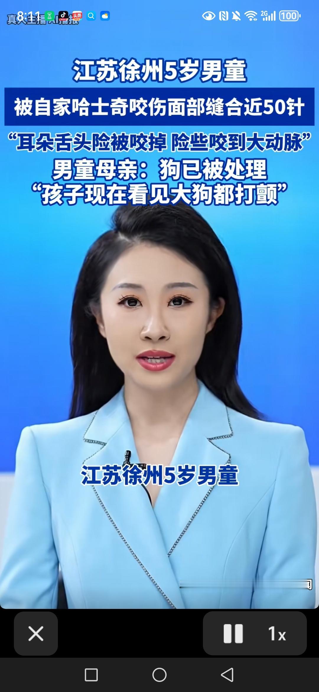 儿童被自己家养的狗咬伤面部，缝了五十针，险些丧命。够已被处理。