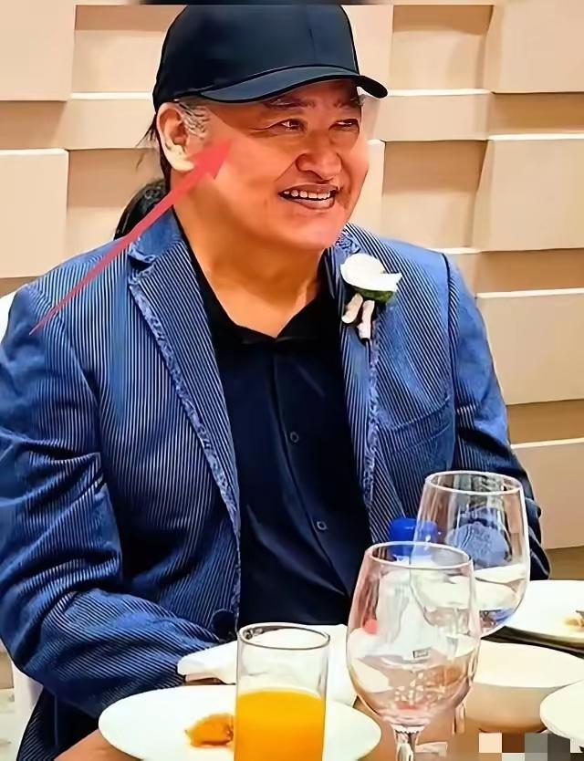 果然面相是会骗人的刘欢就是个例子去年10月女儿婚礼上，他能吃能喝，面色红润，