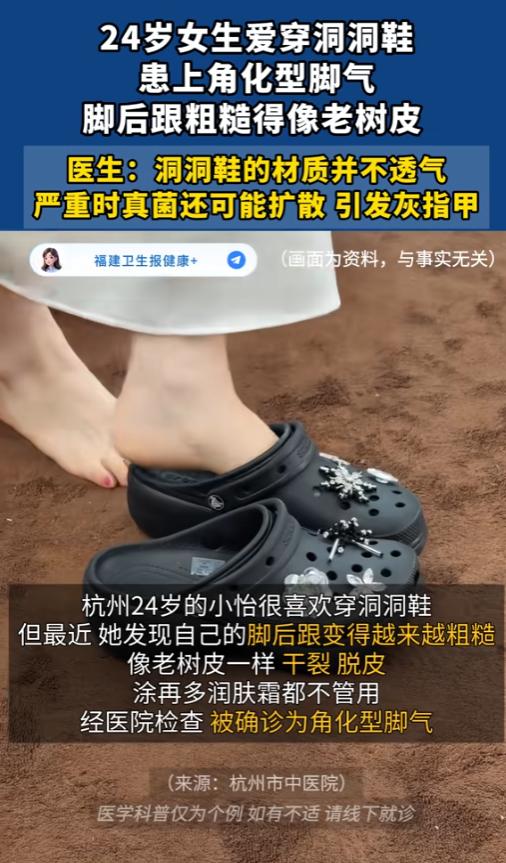 “爱穿洞洞鞋的人天都塌了！”6月25日报道，浙江杭州，一位24岁的女生平时很喜欢