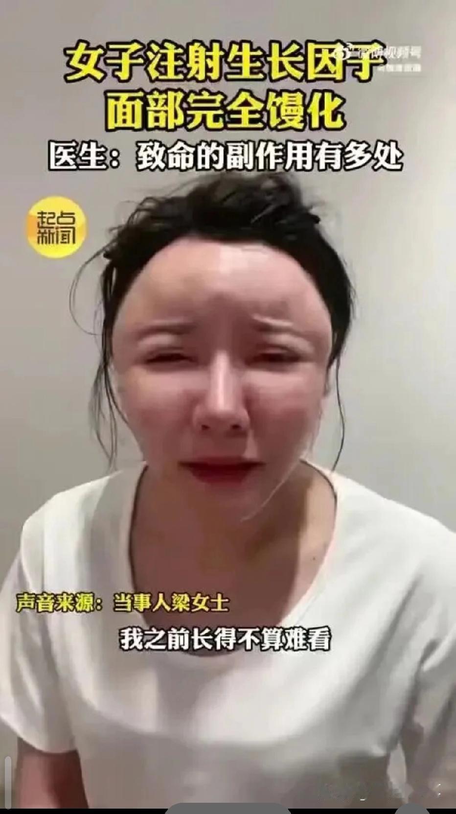 女子做医美“面部馒化”似面具人：原本不算难看，整个脸变形毁容了，不敢照镜子！