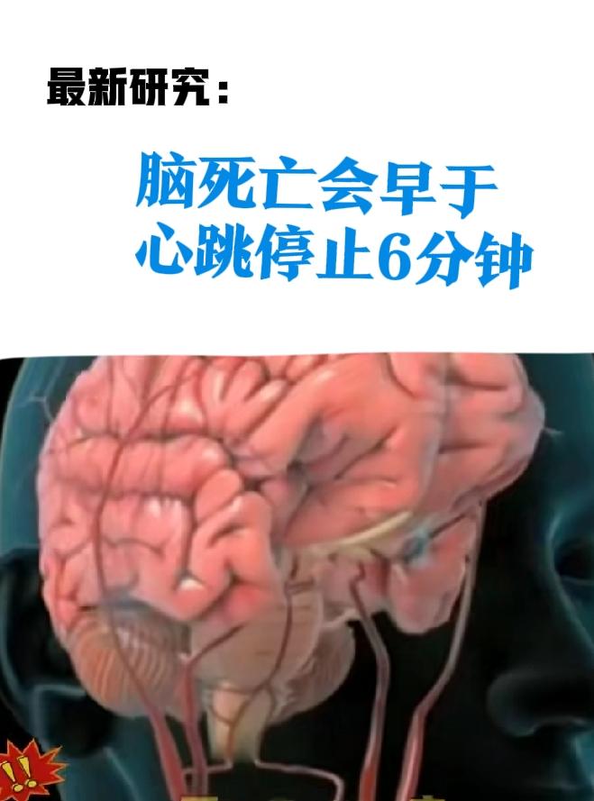 大脑先死，心脏善后，这种顺序有尊严国际医学最新的研究结果，大概内容是，大脑死亡
