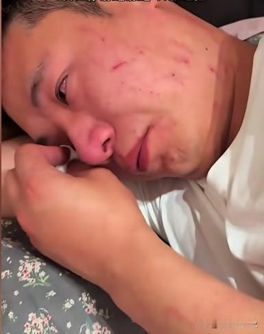 丈夫手机屏幕碎裂，喝醉进门。妻子怨气爆发，尖叫着在他脸上抓出血痕。一场发泄后，