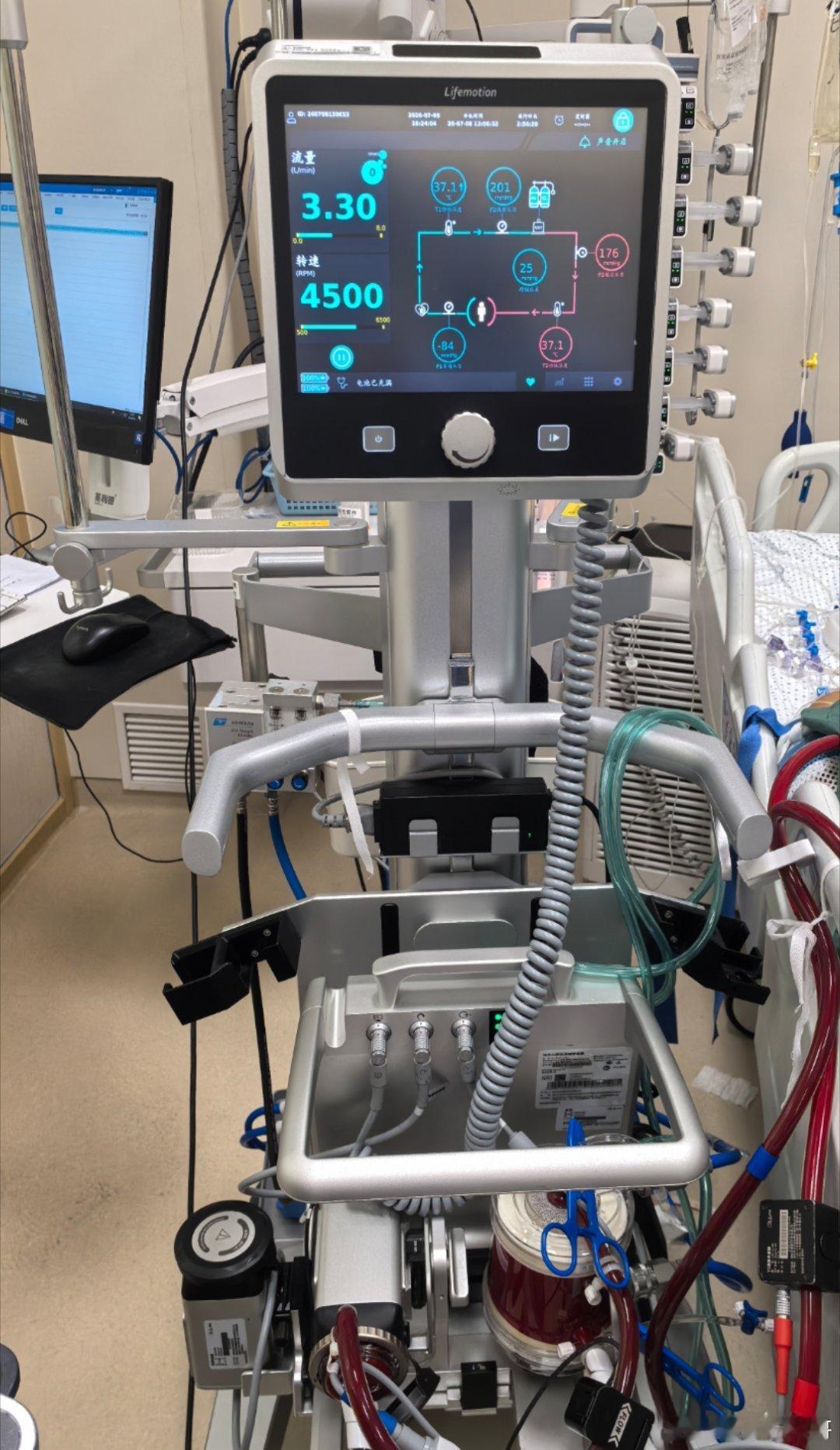 刚才上了一个ECMO，这样的白肺患者搁在以前必死无疑，搁在现在，出5万...