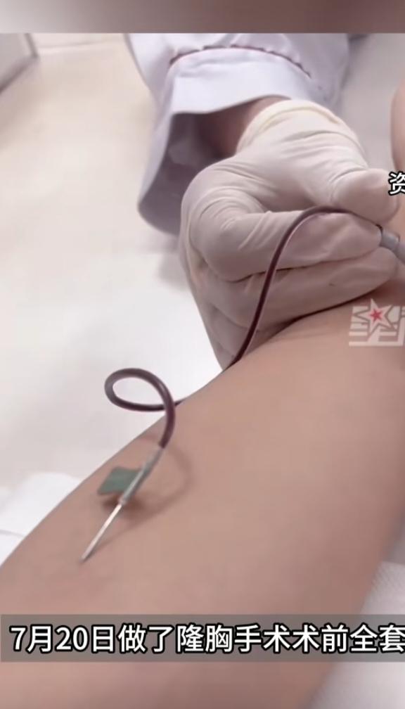 女子全麻隆胸术后查出怀有双胞胎花1.8万隆胸，一周后查出怀孕5周还是双胞胎，这