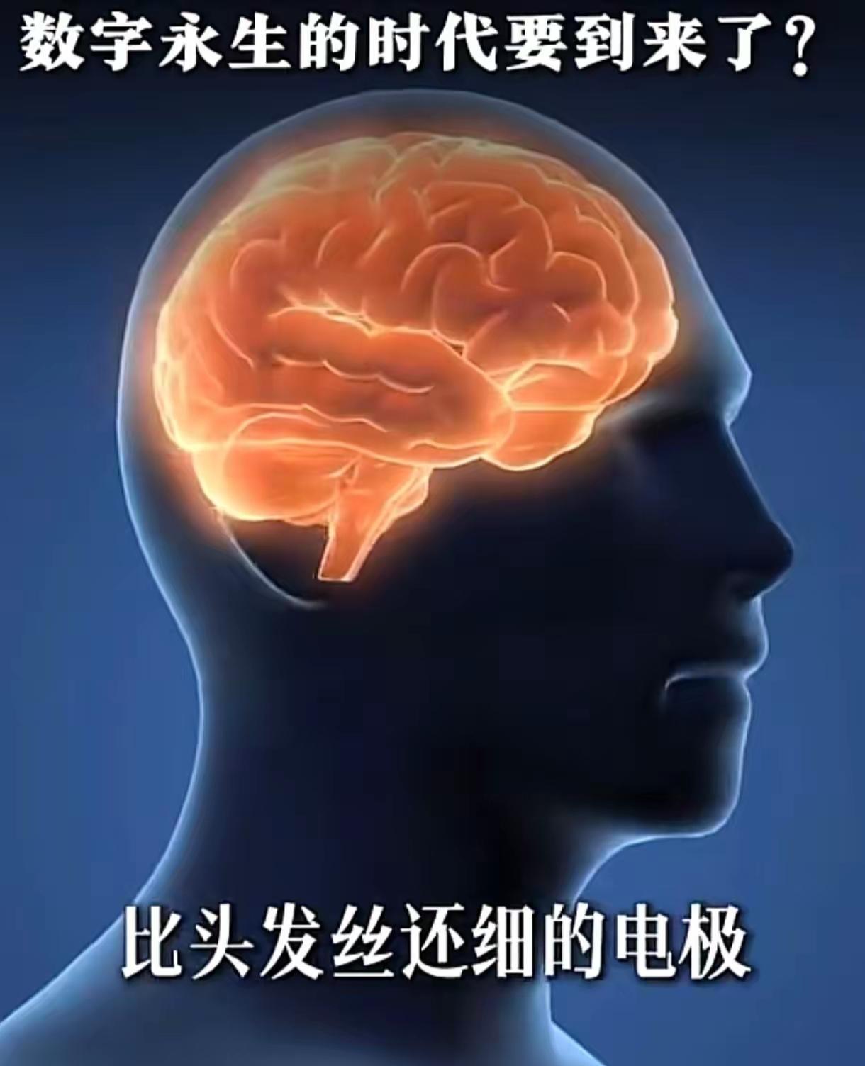 马斯克的脑机接口即将量产，不少人都觉得这是划时代的好东西——未来人类能用意念直接
