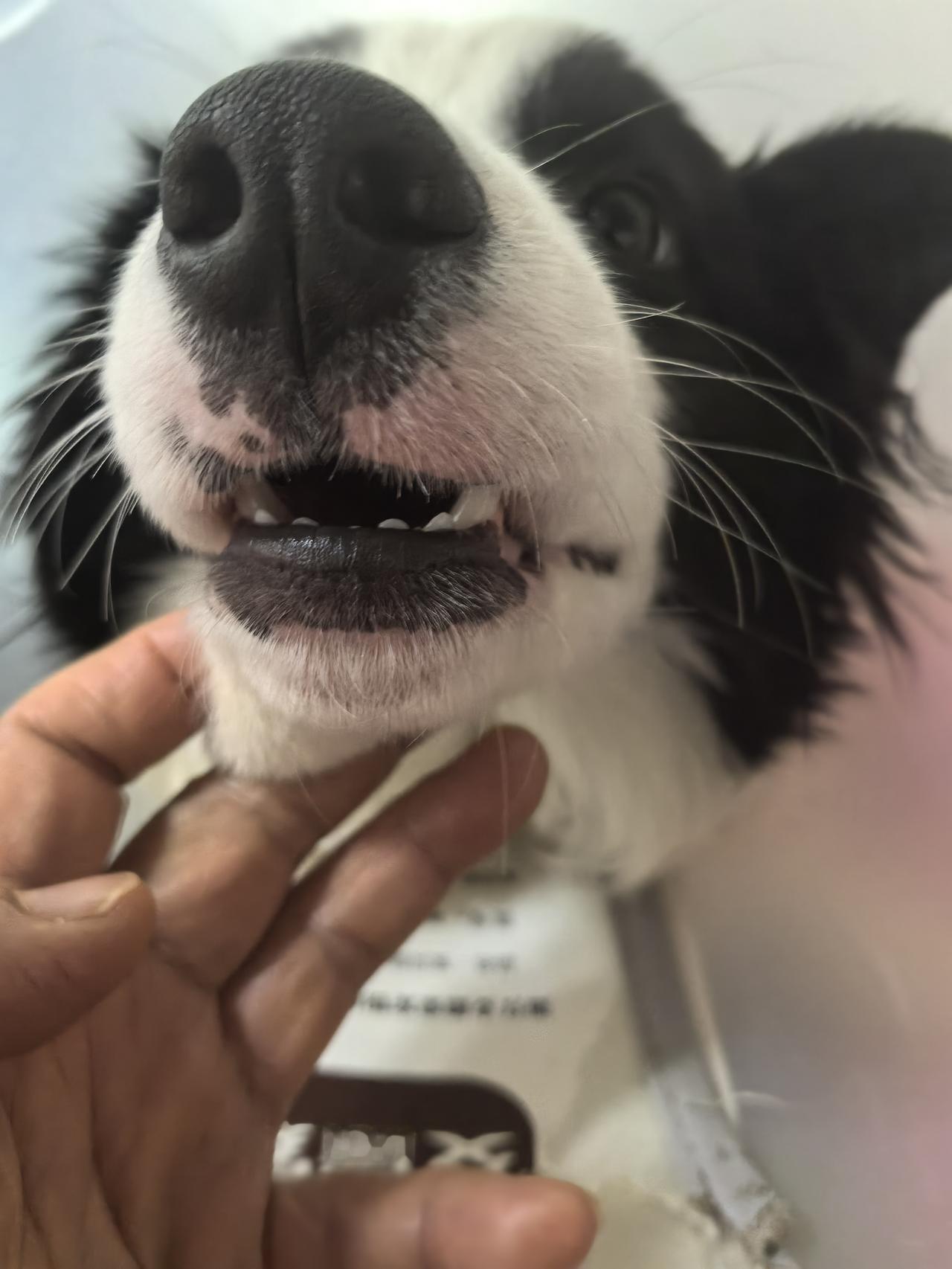 今天去牙科复诊看牙医，医生仔细检查了一下我的牙齿，告诉我，牙齿根管治疗装