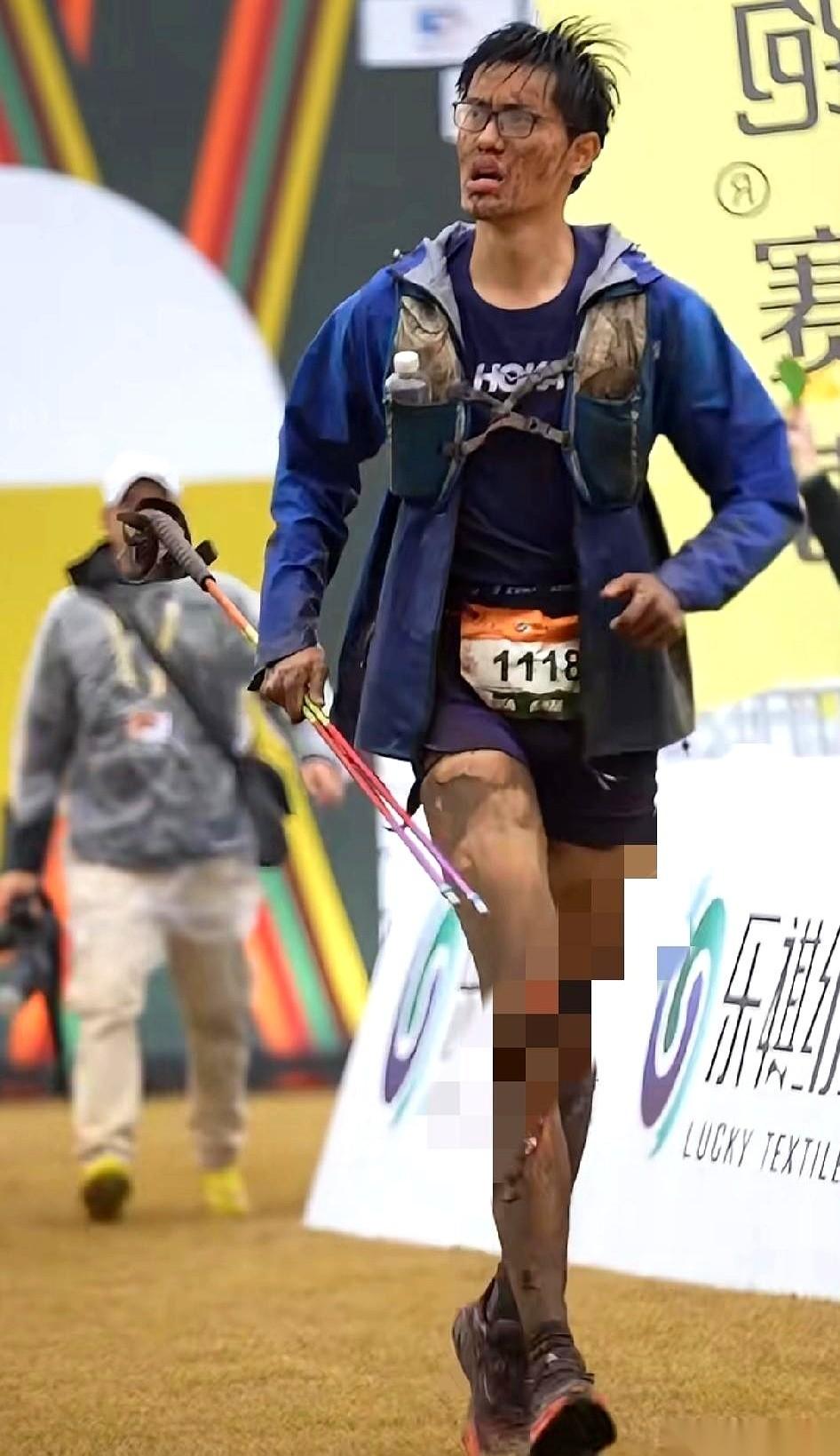 说真的，这膝盖我第一眼以为是电影特效。一整块皮，就这么没了，血肉模糊的。而他