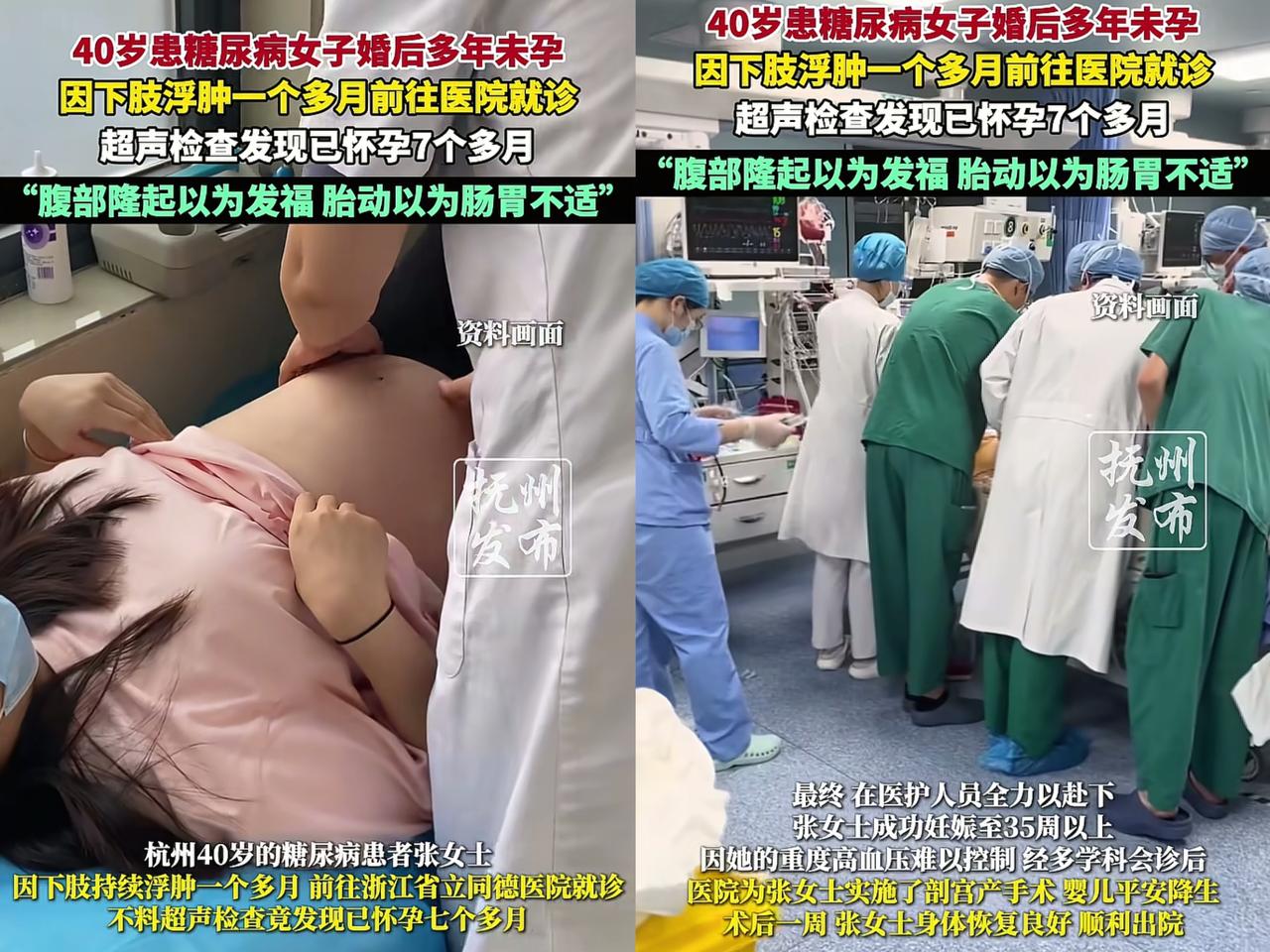 你敢相信吗？杭州一位40岁的糖尿病患者，因为下肢浮肿去医院，结果发现自己