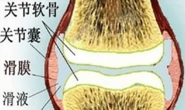滑膜炎? 为啥不用消炎药?