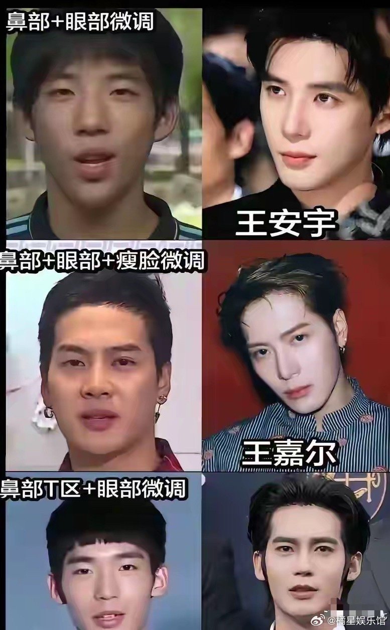 以前叫:整容现在叫:微调，医美