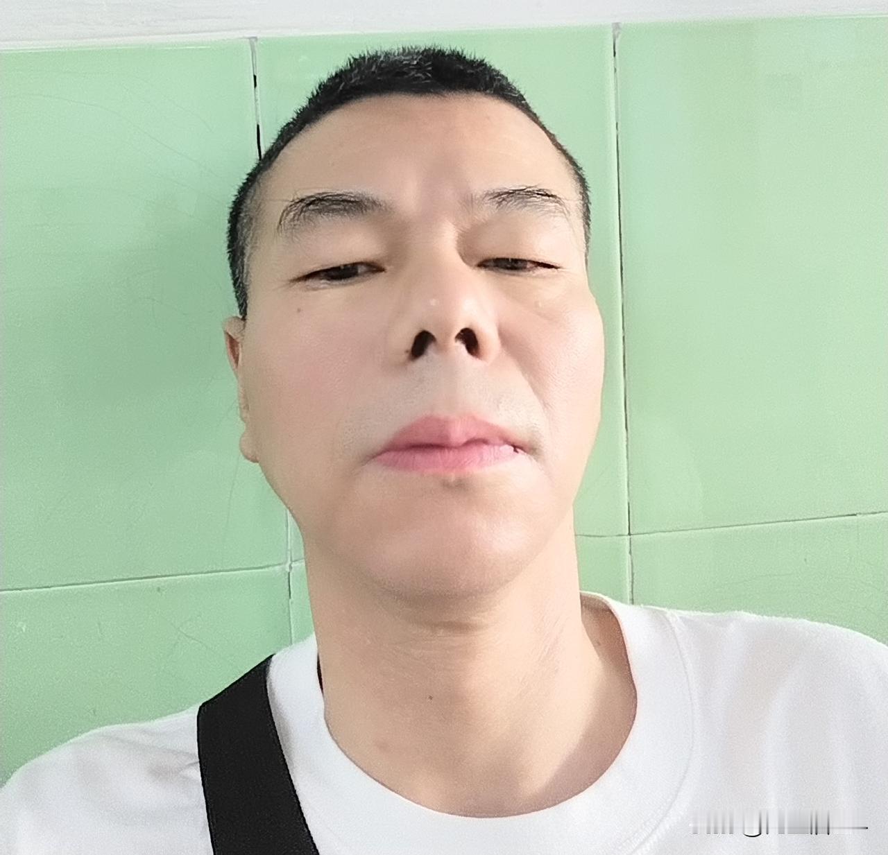 胃癌术后三年了，不再想太多！8月23日，是胃癌术后整三年，这次检查结果总体还好