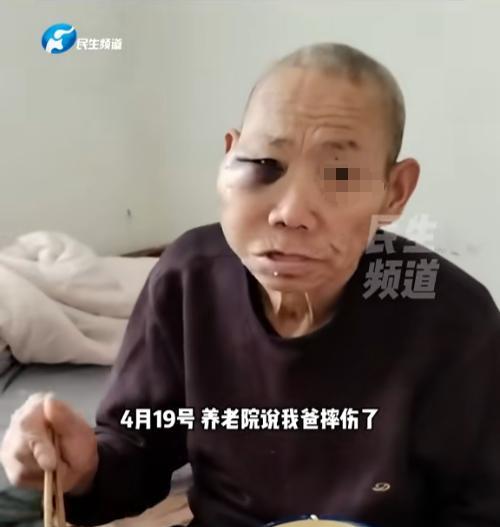 河南南阳，女子把71岁的父亲送进养老院，结果接到消息，说父亲摔伤了，她去医院一看