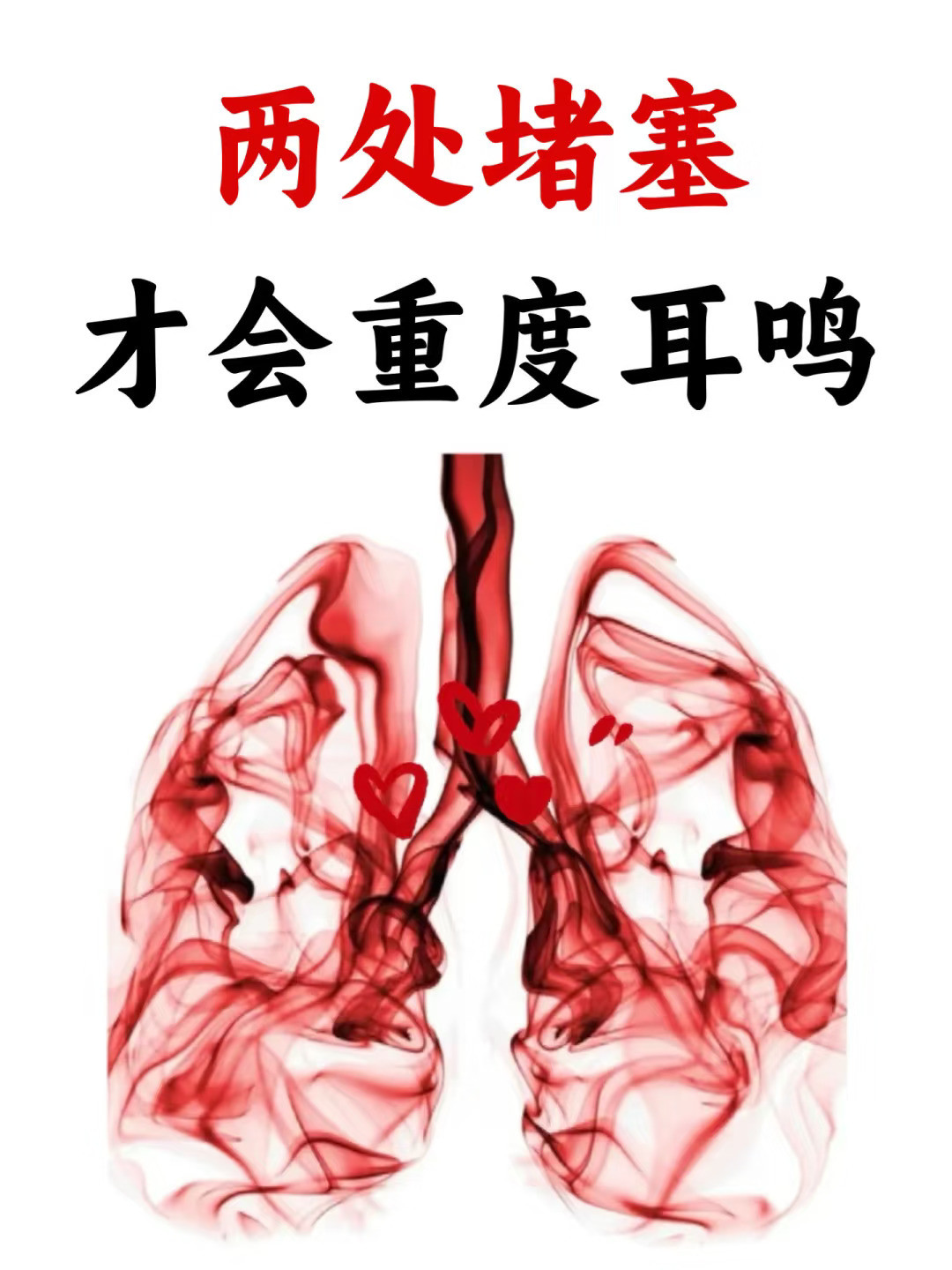 两处堵塞才会耳鸣  很多人认为耳鸣不过是耳朵里偶尔出现的杂音...
