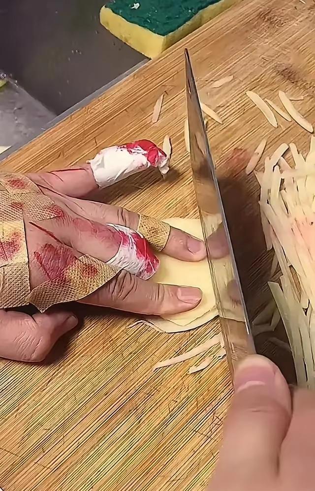 切土豆丝学会了，就是代价有点大