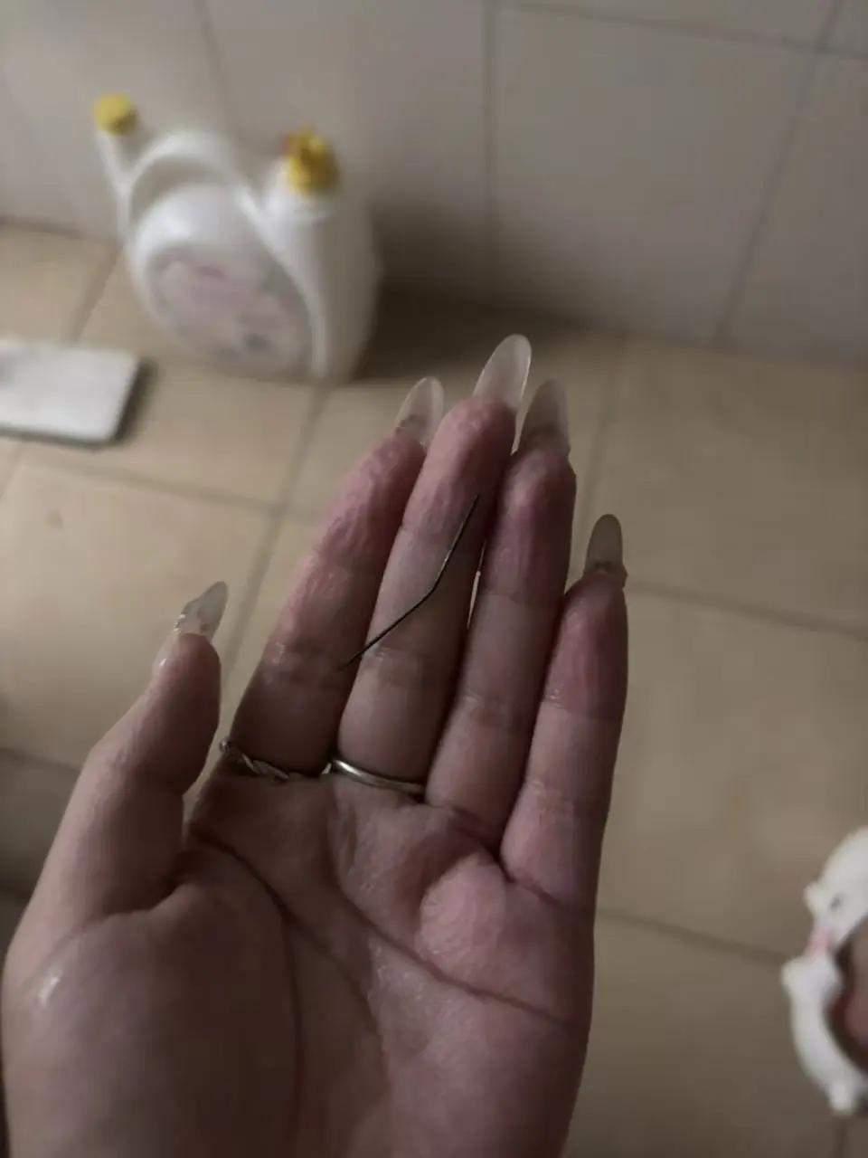 说实话，看到这则新闻的时候，我后背都麻了一下。浙江一位女士，左臀疼了整整一个