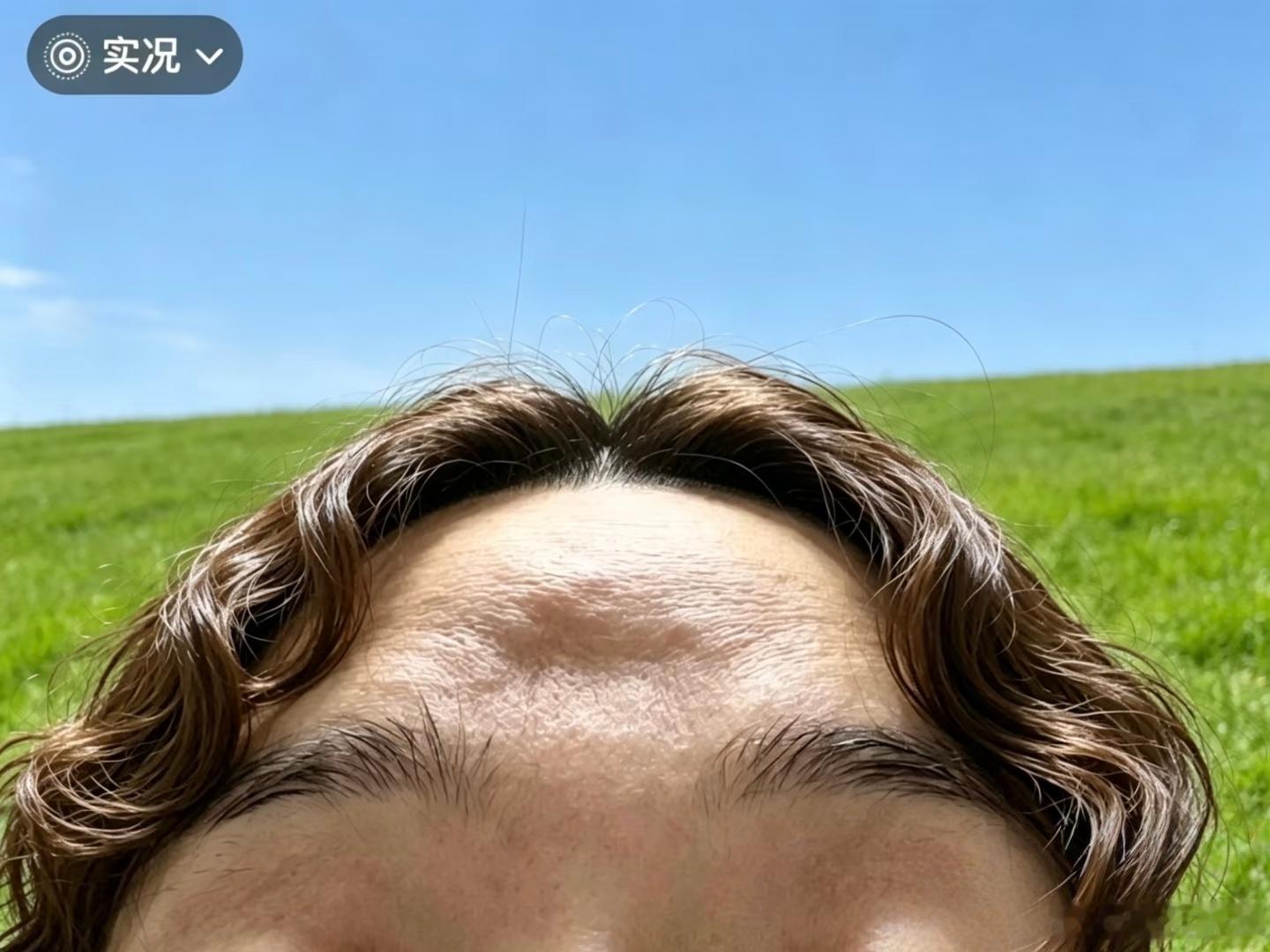 这样的额头，必定是心有千千结表面看是胶原蛋白流失、年纪增长带来的凹凸、松弛、垮脸